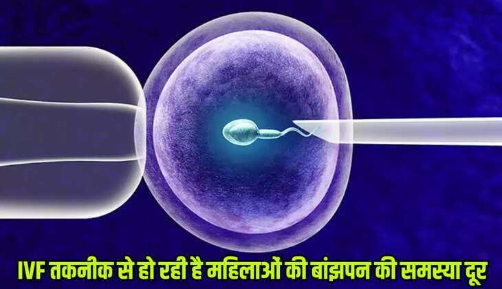 ivf technology