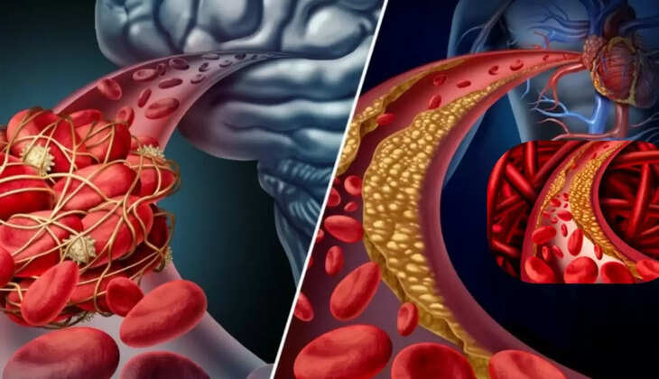  risk of heart attack 