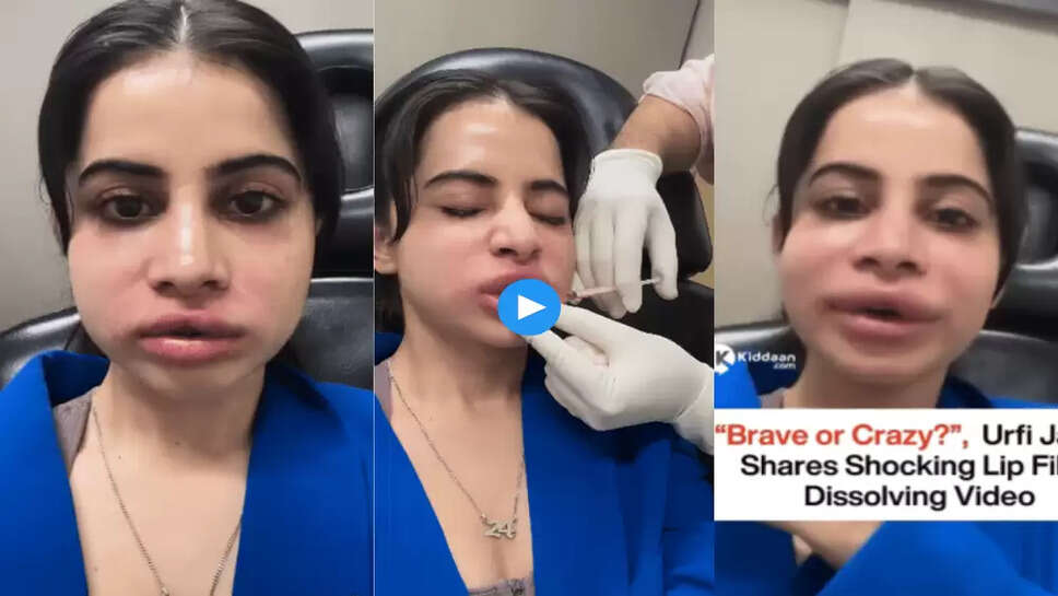 Urfi Javed के सूजे हुए होंठों को देख हैरान हुए फैंस