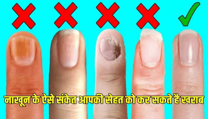 नाखून के ऐसे संकेत आपकी सेहत को कर सकते है खराब