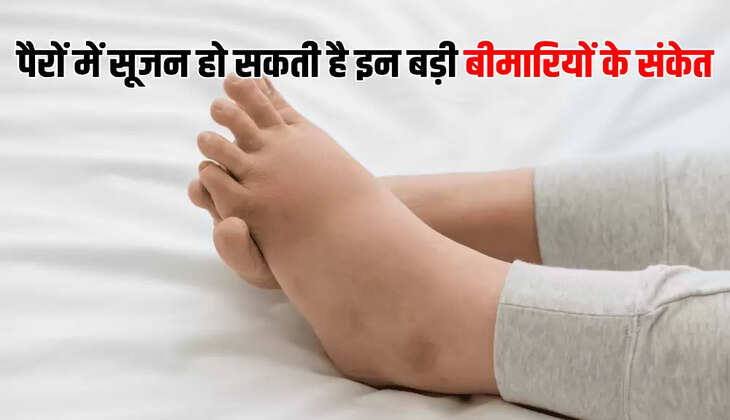 पैरों में सूजन हो सकती है इन बड़ी बीमारियों के संकेत