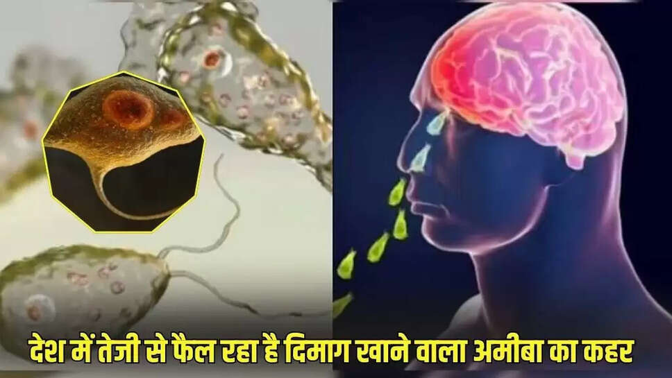 Brain eating amoeba