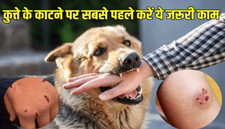 कुत्ते के काटने पर सबसे पहले करें ये जरूरी काम
