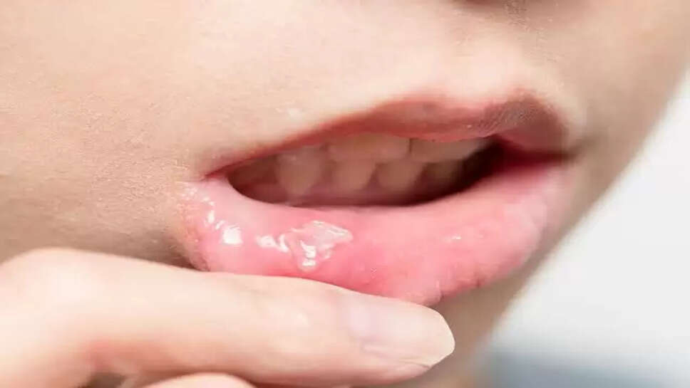 Cancer symptoms 