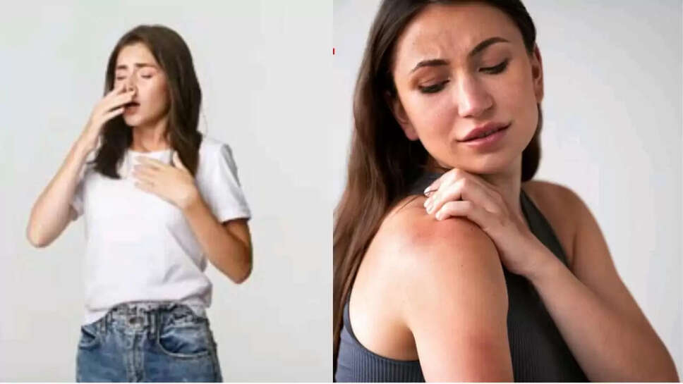 एलर्जी