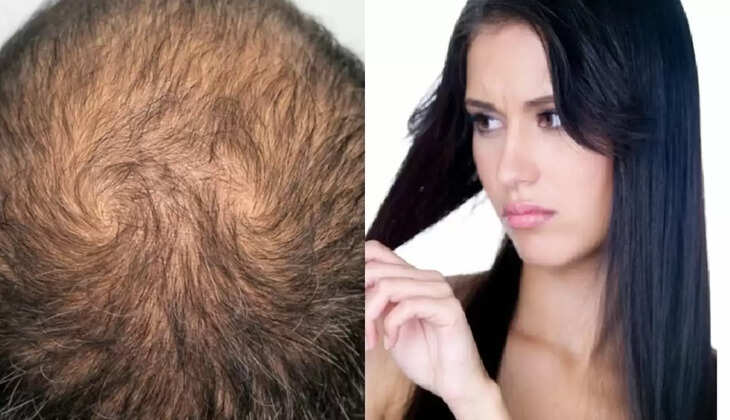 बाल झड़ने 